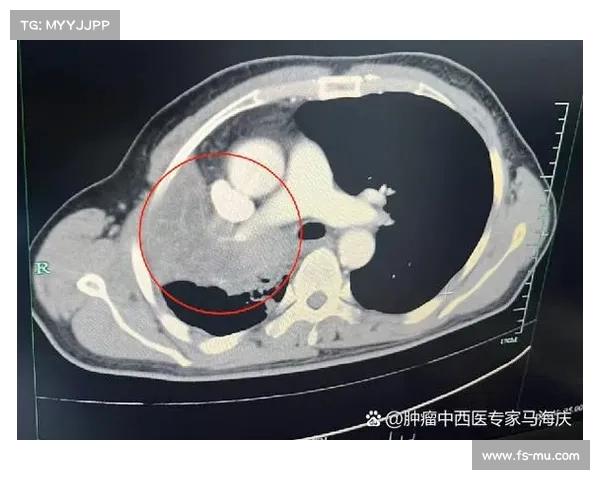 穆西亚拉预计最早11月复出目前仍未出院恢复中 穆西亚拉预计最早11月复出目前仍未出院恢复中
